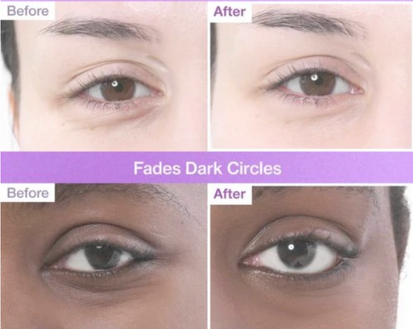 Numbuzin No. 9 NAD+ PDRN Under Eye Patches