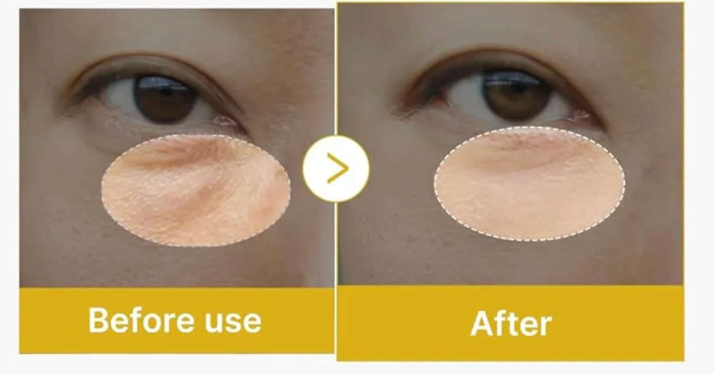 Medicube Kojic Acid Turmeric Vita Eye Gel Serum