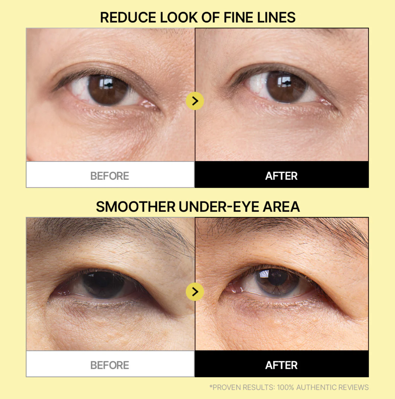 Parnell Firming Eye Patch Bakuchiol+Retinol+Wild Yam