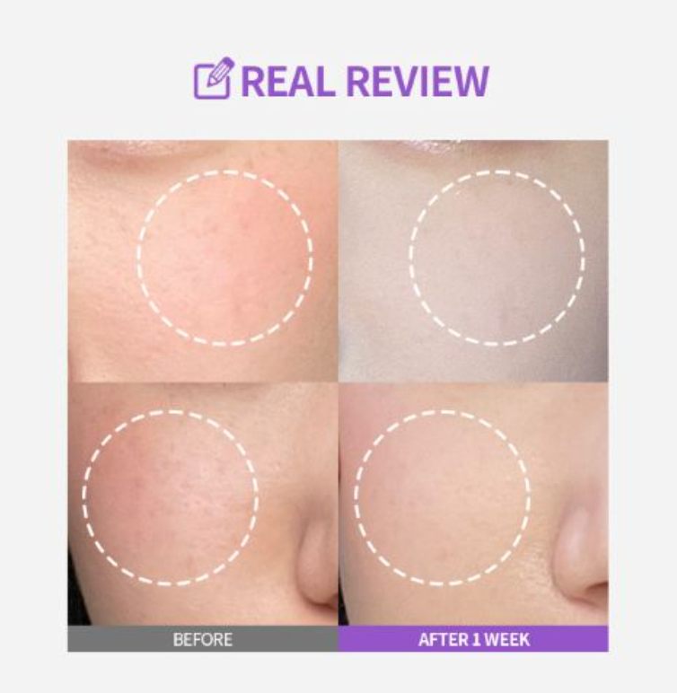 Sungboon Editor Meoru Podo Vita C Dark Spot Ampoule